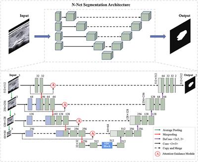 N-Net: A novel dense fully convolutional neural network for thyroid nodule segmentation